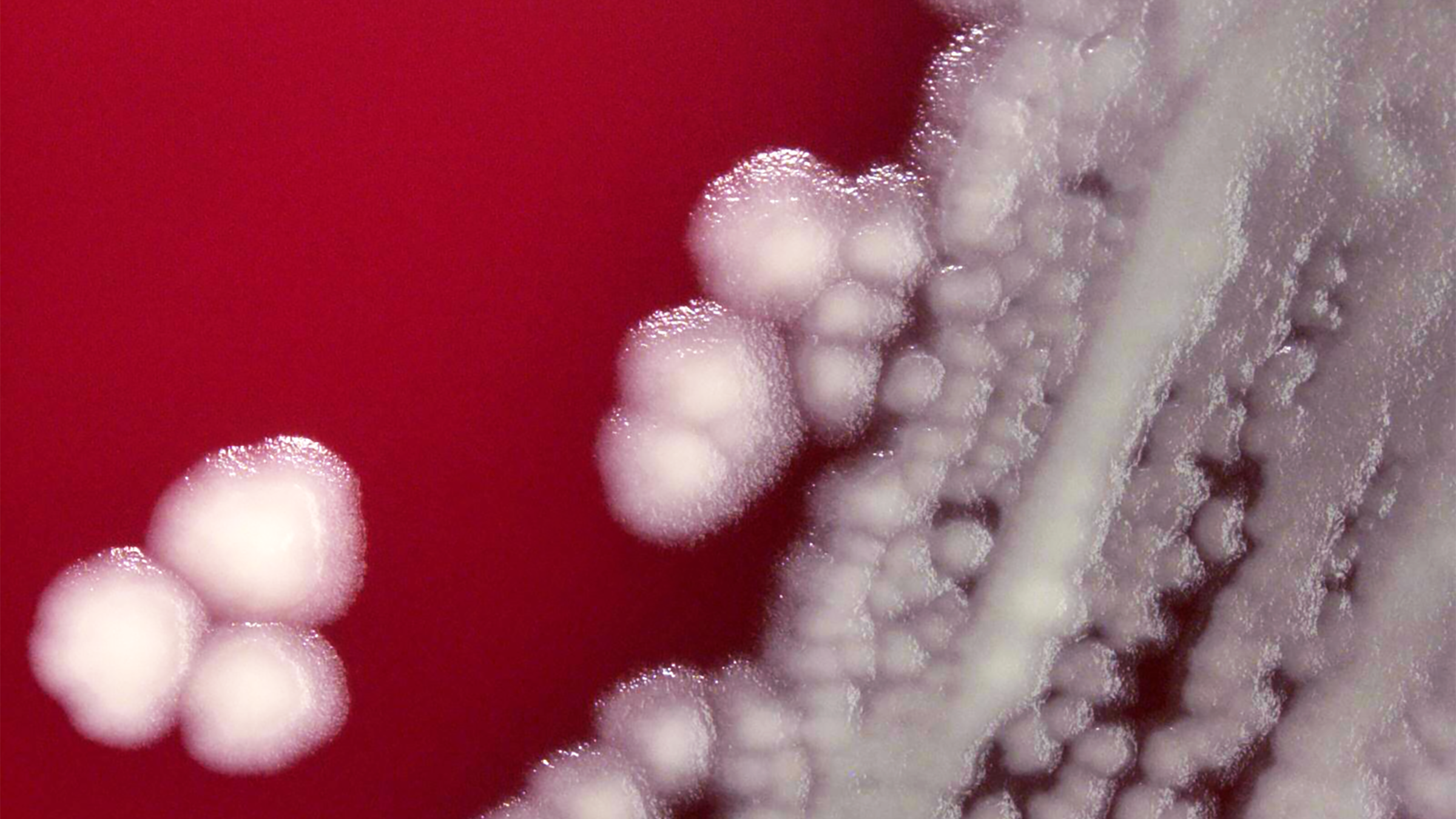White bacterial coloines on a plate of red culture medium